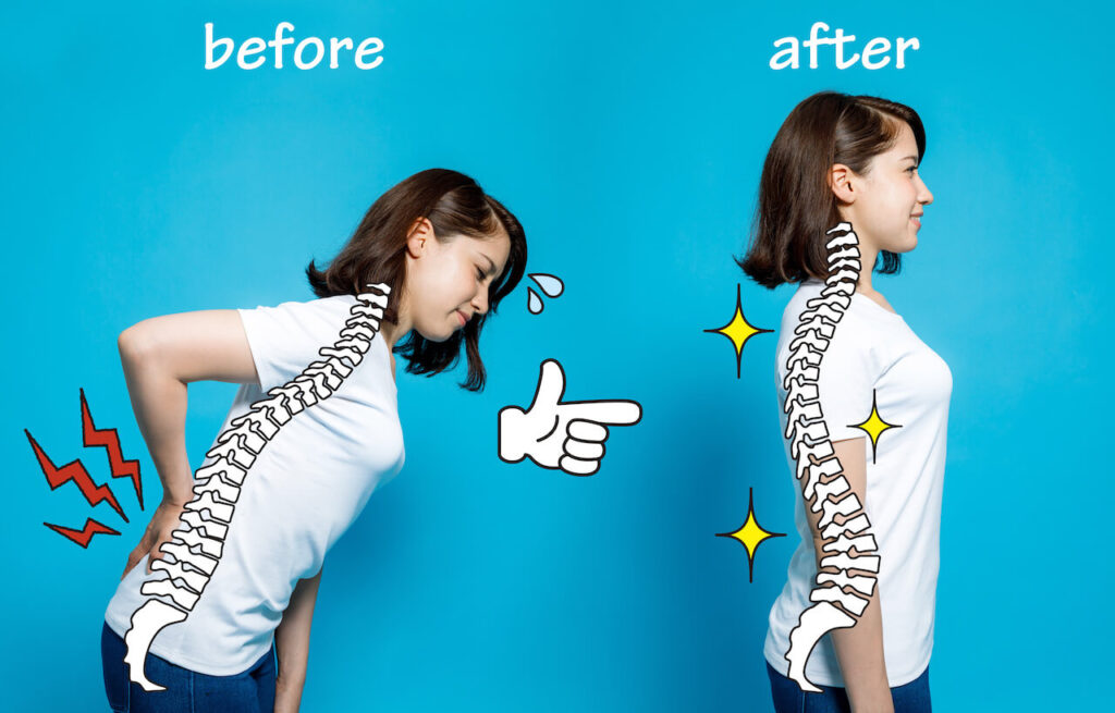 Posture Perfect: How to Correct Your Back Pain